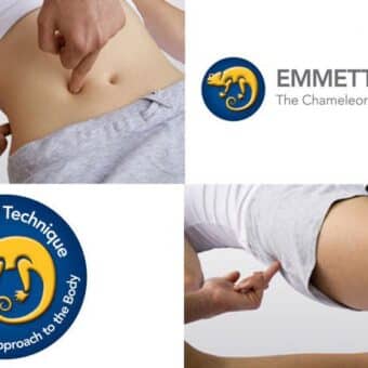 emmett-tehnika-tretman-pritisak-na-misice-rehabilitacija-lovre-antisin-zadar